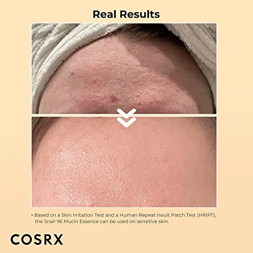 COSRX Advanced Snail 96 Mucin Power Essence 100ml | Snail Secretion Filtrate 96% | Skin Repair Serum | CPNP Registered | Korean Skin Care, Cruelty Free, Paraben Free