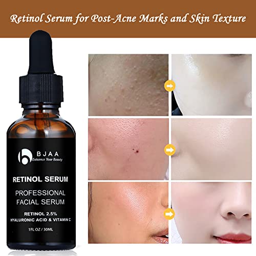 BJAA Retinol Serum - High Strength with 2.5% Retinol, Hyaluronic Acid, Vitamin C & E, and Organic Aloe. Anti-Wrinkle Anti-Ageing Facial Serum for Dark Spot, Fine Lines, Scar and Skin Repair 30ml