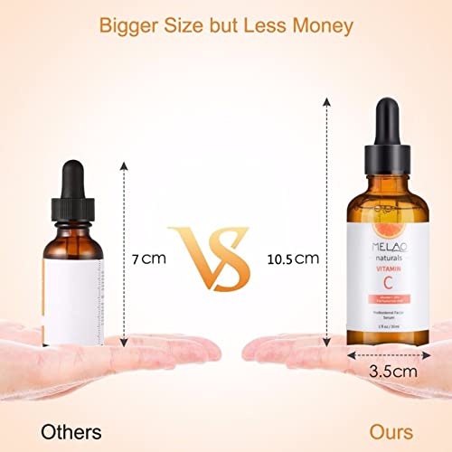 Vitamin C Serum Face Serum, With Hyaluronic Acid,Vitamin E,20% Vitamin C, Skin Care For Hydrate, Brightening, Dark Spot Remover For Face, Organic & Vegan Formula – Restore&Boost Collagen (30ml)