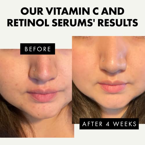 𝗪𝗜𝗡𝗡𝗘𝗥 𝟮𝟬𝟮𝟯* Retinol Serum & Vitamin C Serum, Skin Serum w/Hyaluronic Acid, Aloe Vera, & Jojoba Oil - Anti Aging Serum for Face - Helps to Reduce Fine Lines, Wrinkles and Acne Scar, 30ml x2