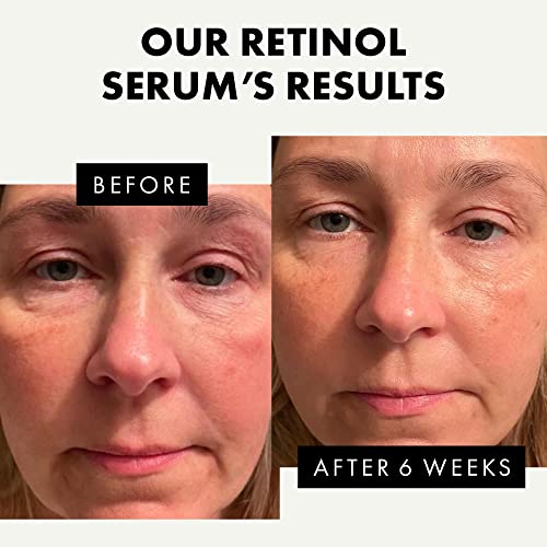 Pure Retinol Serum for Face & Neck (2.5%) - Vitamin A Anti-Aging/Wrinkle/Acne Skin Resurfacing Retinol Serum - Pro Moisturizing & Brightening Prescription Strength Retinoid Treatment for Women & Men