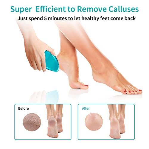 Foot File, Nano Glass Hard Skin Callus Remover, Foot Scraper Salon Home Pedicure Tool for Foot Beauty Care, Can Be Used on Both Wet/Dry Cracked Feet, Foot Rasp by AnjoCare