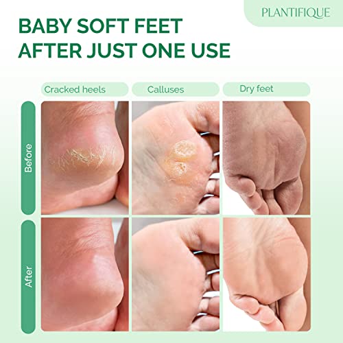 Foot Peel Mask with Avocado by Plantifique - 2 Pack Foot Mask Dermatologically Tested - Repair Heels & Removes Dry Dead Skin for Soft Baby Feet - Exfoliating Foot Peel Mask for Hard Skin - Peeling