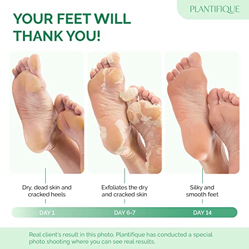 Foot Peel Mask with Avocado by Plantifique - 2 Pack Foot Mask Dermatologically Tested - Repair Heels & Removes Dry Dead Skin for Soft Baby Feet - Exfoliating Foot Peel Mask for Hard Skin - Peeling