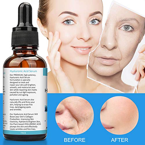 Hyaluronic Acid Serum for Dry Skin, Natural Anti Ageing & Anti Wrinkle Serum for Skin Face, Face Serum, Best Choice for Skin Care and Neck - 30ml