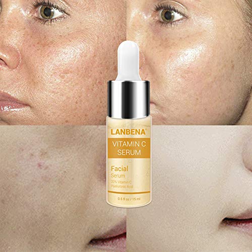 Vitamin C Serum - LANBENA Whitening Serum with Hyaluronic Acid Face Essence Cream Natural Ingredients for Repairing Fades Age Sports and Sun Damaged Skin 15ml