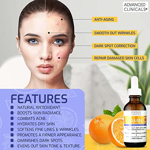 Advanced Clinicals Advanced Clinicals Vitamin C Anti-Aging Serum For Dark Spots, Uneven Skin Tone, Crows Feet And Expression Lines. 1.75 Fl Oz.