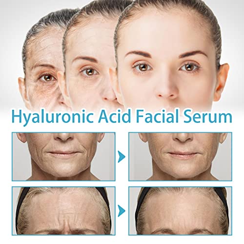 LOVOICE Hyaluronic Acid Face Serums,30ml Hyaluronic Acid Serums with Vitamin C,Oil Control Anti-Aging Skin Face Care,Skin Moisturizing Whitening Facial Essence