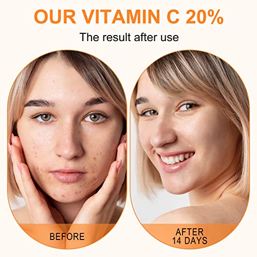 Premium 20% Vitamin C Serum For Face with Hyaluronic Acid, Retinol & Amino Acids - Boost Skin Collagen, Brighten Hydrate & Plump Skin, Anti Aging & Wrinkle Facial Serum